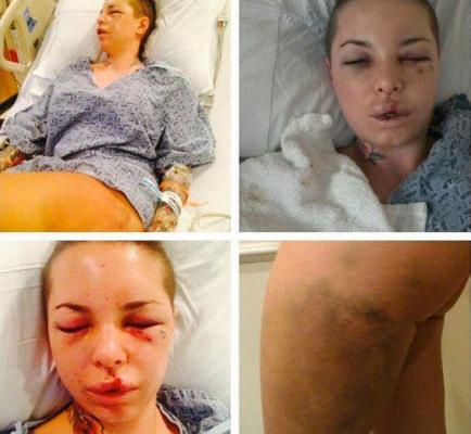 Cum arată o femeie BĂTUTĂ DE UN LUPTĂTOR MMA!