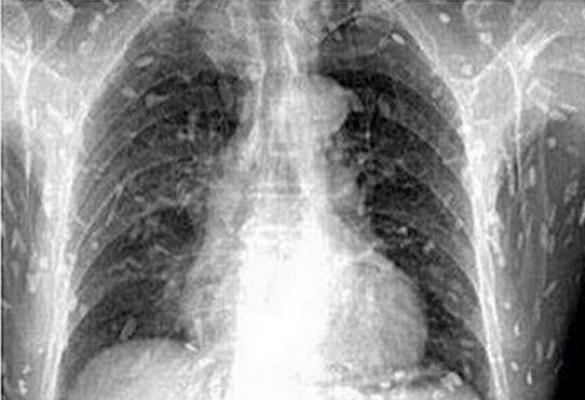 Se plângea de dureri de burtă. La spital a fost OPERATĂ de URGENȚĂ!