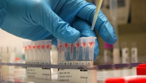 Sunt la ORDINEA ZILEI în meniul nostru! Dacă ai consumat aceste produse trebuie să mergi la medic