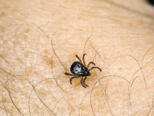 Cea mai eficientă SOLUȚIE împotriva CĂPUȘELOR! O poți prepara singur(ă) acasă