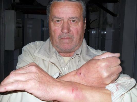 Aviator erou, pensionat şi operat de cancer, STÂLCIT ÎN BĂTAIE de poliţişti! "M-au călcat în picioare, apoi m-au târât pe jos, ca pe un animal!"