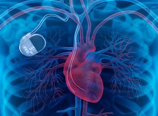Hackerii îți pot ataca inima! Sute de mii de stimulatoare cardiace sunt vulnerabile la atacuri cibernetice!