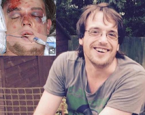 Terifiant! Un tânăr a fost CĂLCAT ÎN PICIOARE de un vecin, pentru că s-a plâns de lătratul unui câine. Victima a murit după ce a stat doi ani în COMĂ