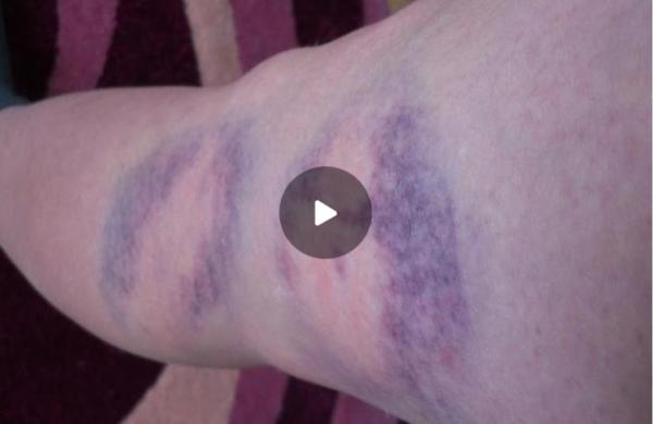 Semnal de alarmă din Todireşti. Elevul huligan, care şi-a bătut profesoara cu ţeava de la calorifer, are aceeaşi atitudine violentã fizic şi verbal fatã de colegi şi sfideazã în continuare cadrele didactice