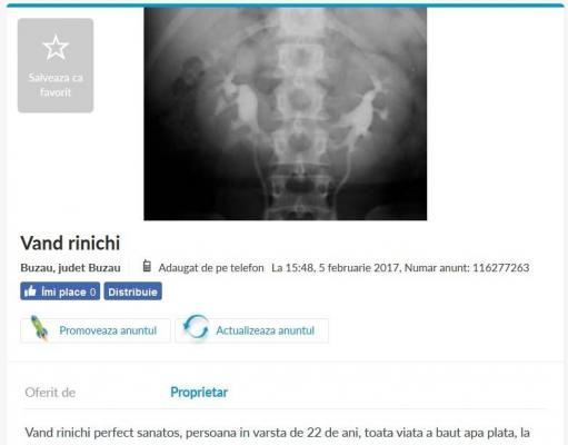 Anunţul îngrozitor al unui buzoian naşte controverse: ÎMI VÂND RINICHIUL. "Stângul sau dreptul, la alegere, am băut doar apă plată"