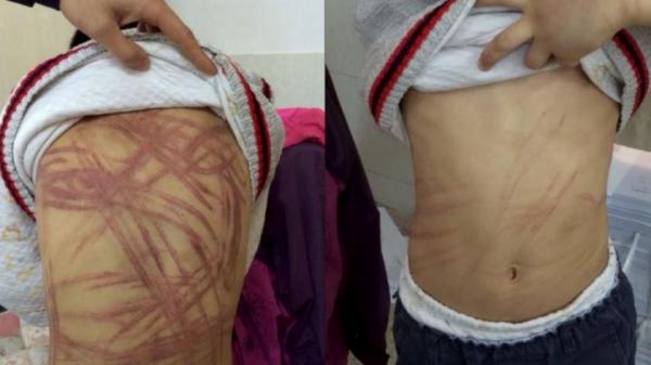 Autorităţile din Bihor au demarat o ANCHETĂ în cazul COPILULUI BICIUIT fără milă de concubinul mamei