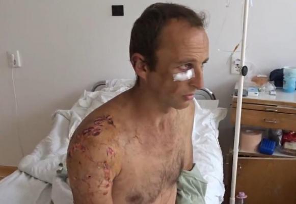 ATAC FULGERĂTOR! Un URS s-a năpustit asupra unui bărbat din Harghita, care era la cules de ciuperci! Rănit grav, omul a făcut un gest care i-a salvat viaţa (VIDEO)