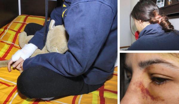 Fata bătută de iubit la Ploieşti a povestit pentru Observator ororile prin care a trecut