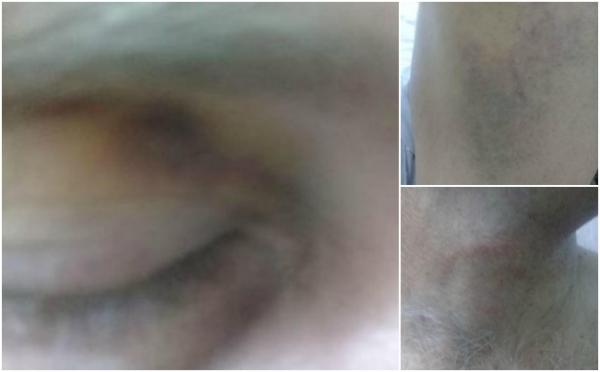 Infirmieri de la Spitalul Judeţean Satu Mare, acuzaţi că au bătut un pacient cu probleme psihice