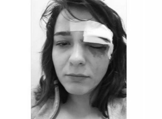 O tânără din București a povestit pe Facebook cum a fost tâlhărită și bătută pe stradă