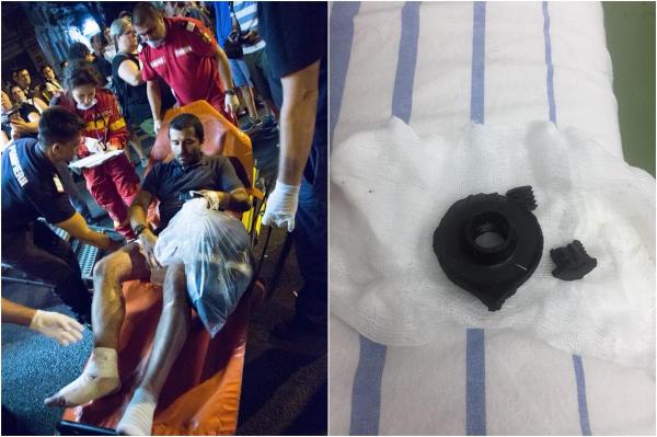 "Medicul mi-a arătat capacul de la grenadă scos din mușchi". Declarația șocantă a protestatarului infectat cu Clostridium după ce a fost rănit în Piața Victoriei (Video)