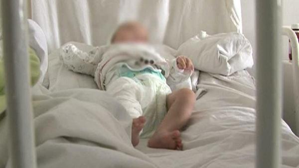 Bebeluş de numai 1 an, opărit cu apa clocotită pentru ceai. Copilul este în stare gravă