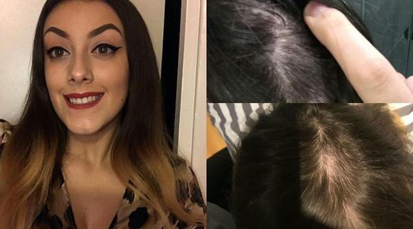 Tânăra a rămas fără o bună bucată din păr