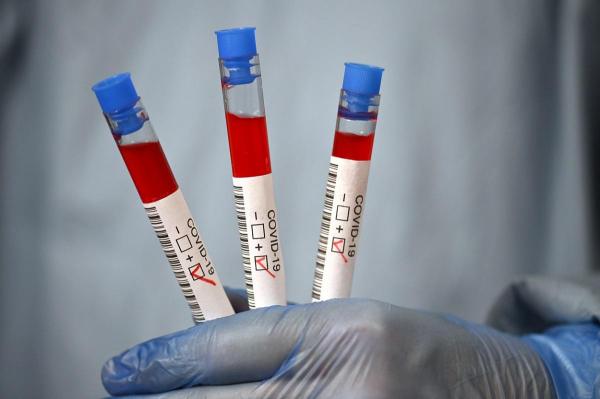 Ultimul loc a fost ocupat de o femeie însărcinată, infectată cu SARS-CoV-2