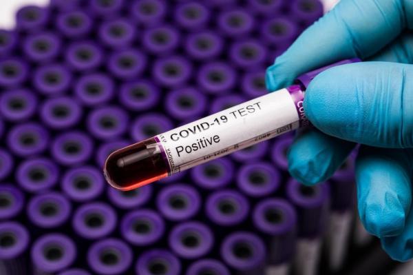 Se schimbă strategia de testare pentru COVID-19 în România. Gravidele și pacienții oncologici, pe lista de priorități