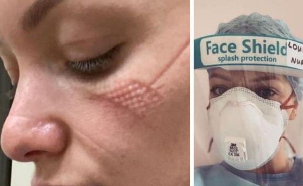Louise Wigginton este asistentă medicală la ATI, în Londra