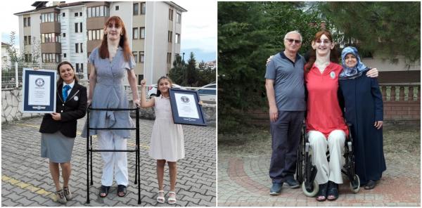Cea mai înaltă femeie din lume, care are peste 2,15 metri, este din Turcia