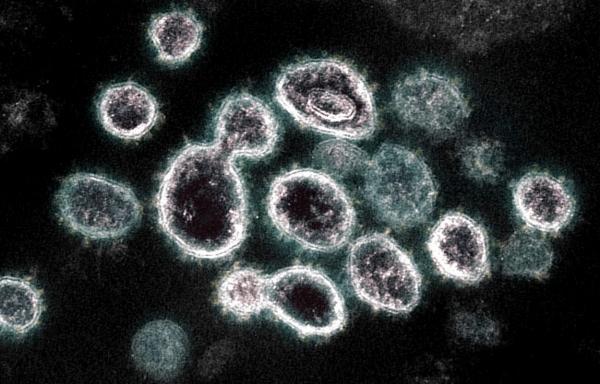 Particule de virus SARS-CoV-2 care provoacă COVID-19, văzute la microscop