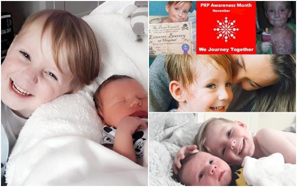 O mamă din Anglia, impresionată până la lacrimi de fiul de 7 ani, care nu a încetat să zâmbească în ciuda cumplitei suferinţe