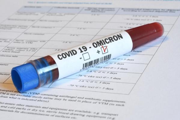 Încă 9 cazuri de infectare cu varianta OMICRON în România