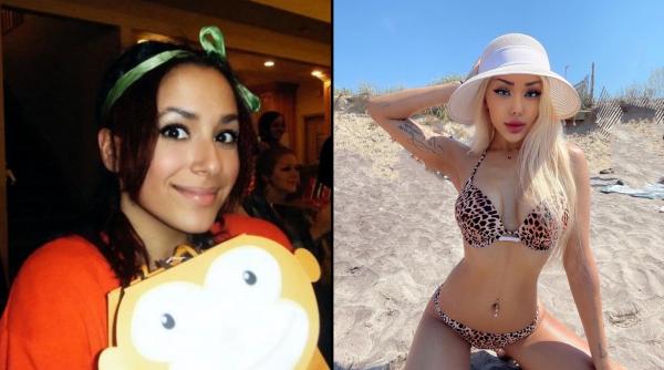 Candice Kloss, o tânără de 21 de ani din SUA care a decis să renunțe la injecții