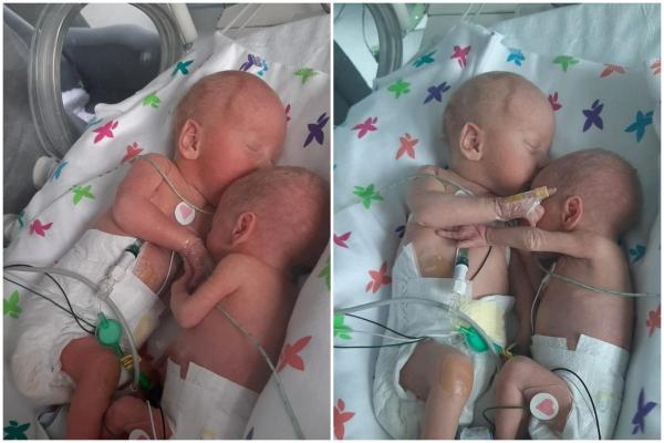 Prima îmbrățișare a unor gemeni, separați imediat după naștere. Mama era să-i piardă pe amândoi