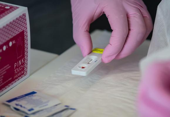 Un test rapid pentru coronavirus