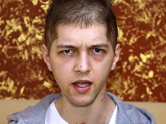 Coşmar fără sfârşit pentru Alexandru, un român de 23 de ani din Italia, care a rămas cu sechele după infecţia cu Covid
