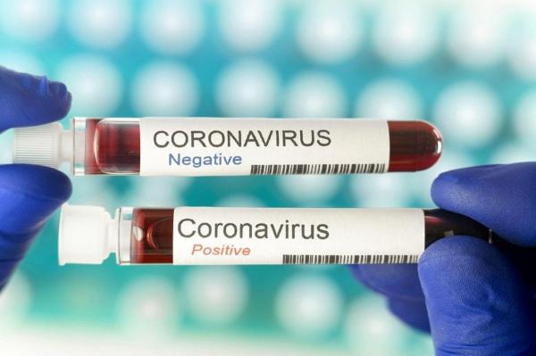 Bilanț coronavirus în România, 5 iunie. 35 de morţi şi 179 de cazuri, în ultimele 24 de ore