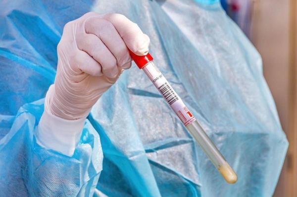 Test pentru depistarea coronavirus