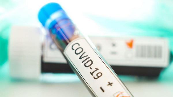 Test pentru depistarea coronavirus