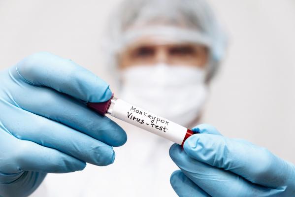 Două noi cazuri de variola maimuței au fost diagnosticate în România.