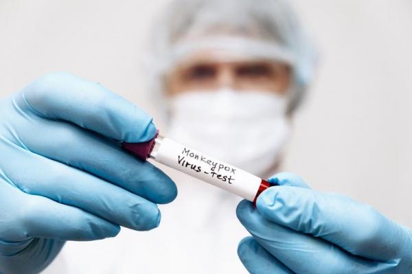 Al 16-lea caz de variola maimuţei, diagnosticat în România