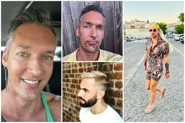 Mărturii ale pacienţilor infectaţi cu variola maimuţei