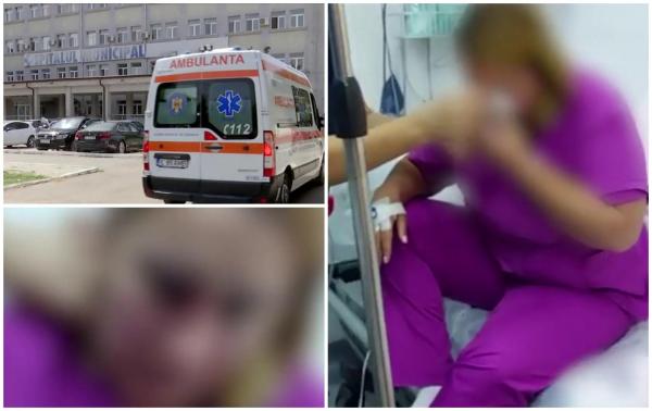 Doctoriță, bătută de un pacient și internată cu fractură de piramidă nazală. Bărbatul ar fi cerut radiografie în timpul nopţii