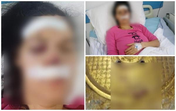 "De ce ai dat în mine, mă, idiotule?" O femeie bătută cu bestialitate pe o stradă din Ploieşti pentru că a parcat neregulamentar