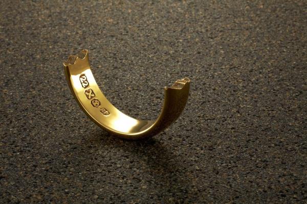 Intervenţie neobişnuită pentru pompierii din Botoşani. Au fost chemaţi la spital pentru a tăia cu flexul verigheta unui pacient