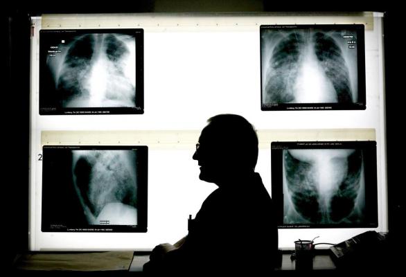 „Mi-a distrus total viața”. Un fost radiolog, acuzat de viol asupra unor paciente, condamnat la 17 ani de închisoare, în Franța. O fată de 15 ani, printre victime