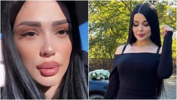 Tânără de 22 de ani, moartă după ce a vrut să-și mărească fesele într-un cabinet neautorizat, în Rusia. Prietena ei era "medicul"