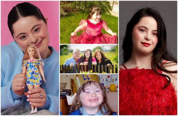 "Le-au spus părinţilor mei să mă abandoneze la spital". Tânăra cu sindrom Down căreia medicii nu i-au dat nicio şansă. A ajuns pe cele mai râvnite coperţi