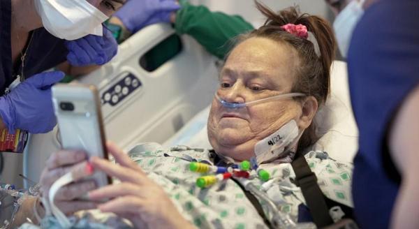 Femeia, care a primit un rinichi de porc modificat genetic şi o pompă cardiacă mecanică, a murit