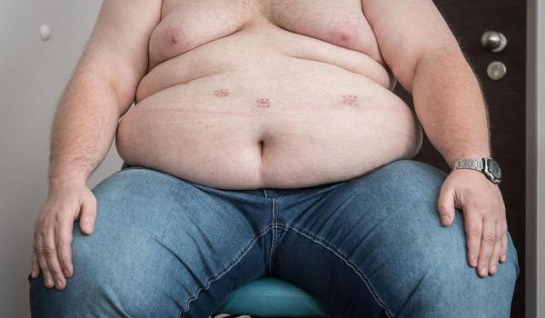 OMS cere acces global la tratamentele moderne pentru slăbit și explică modul corect de utilizare