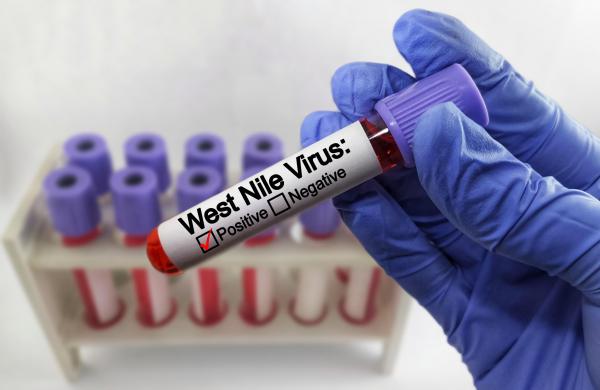 virusul West Nile