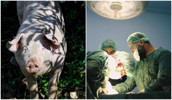 Plămân de porc, transplantat la un pacient aflat în moarte cerebrală. Cum a decurs procedura medicală