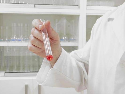 O femeie a murit de ciumă în Rusia, după ce o eprubetă s-ar fi spart la Institutul de Combatere a Ciumei