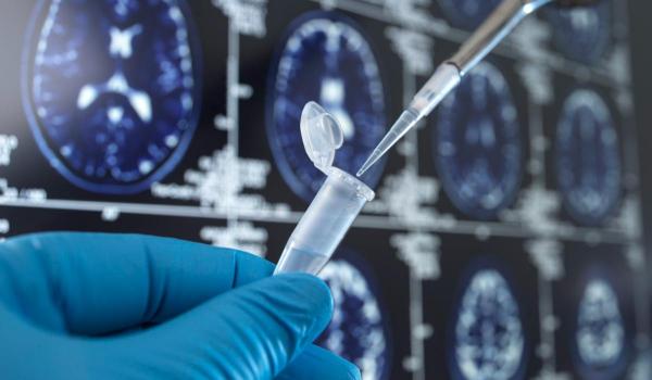 La ce să fim atenţi dacă vrem să prevenim demenţa. Multe simptome sunt considerate "normale"