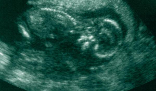 A mers la doctor pentru o durere de stomac şi a aflat că este în travaliu: "Ai un copil în tine şi vine acum"