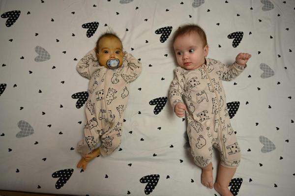 Povestea a două surori gemene de 11 luni: una e cu familia, alta în stare gravă. Cum o poţi ajuta pe Iuliana