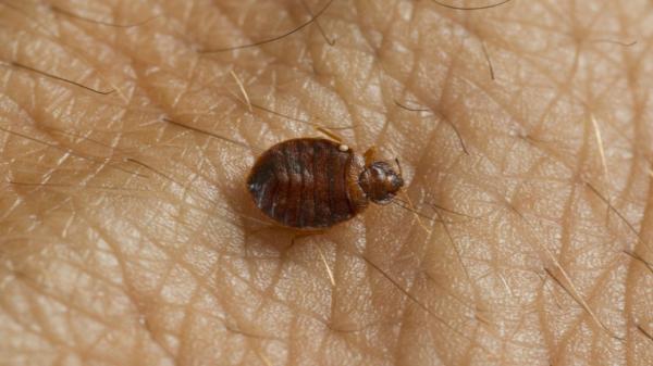 Turist, atacat de ploşniţe la cazare de 4 stele, renovată cu bani UE. A avut o reacţie alergică