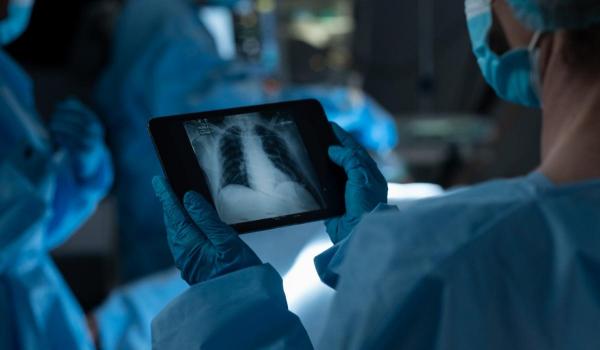 A trăit fără plămâni 48 de ore, până la transplant. Cum l-au ținut medicii în viață